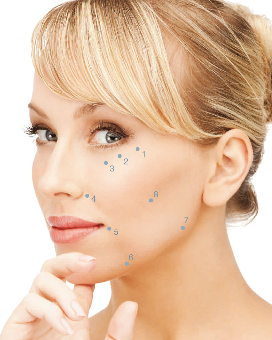 Stellen, an denen das 8-Punkte-Face Liquid Lifting ansetzt