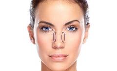 Faltenbehandlung von Bunny Lines
