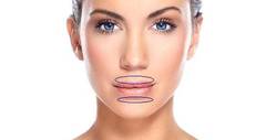 Faltenbehandlung von Lippenfalten