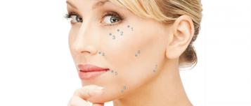 Erfahren Sie mehr über das 8-Punkte-Face Liquid Lifting