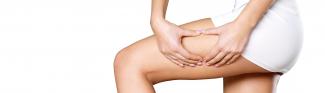 Fettabsaugung / Liposuktion bei Zellulitis (Cellulite)