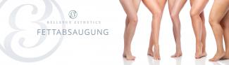 Erfahrungen mit Fettabsaugen (Liposuktion)