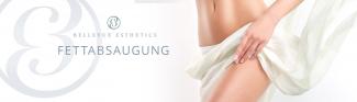 Bilder vor und nach einer Fettabsaugung / Liposuktion bei Männern